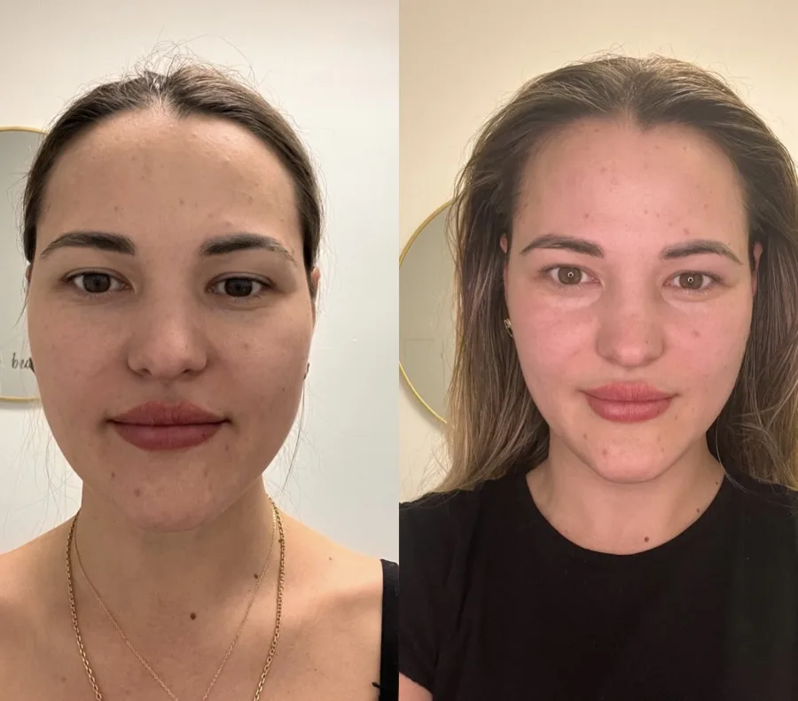 Before and after facial massage result